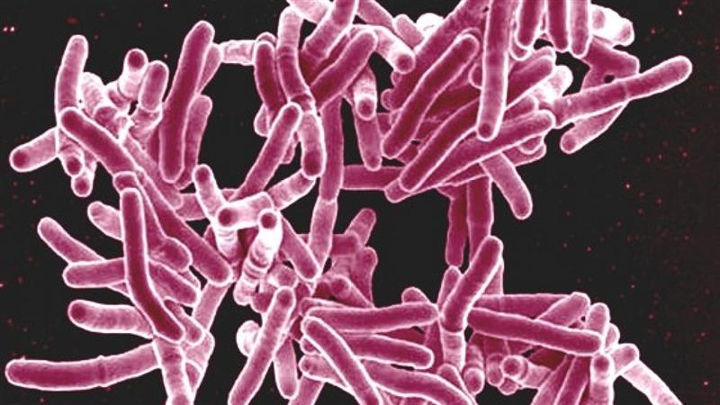 Departamentul de Sănătate din Minnesota urmărește focarele de tuberculoză